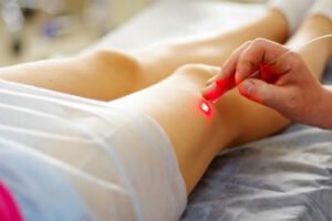 Laser treatment on leg.