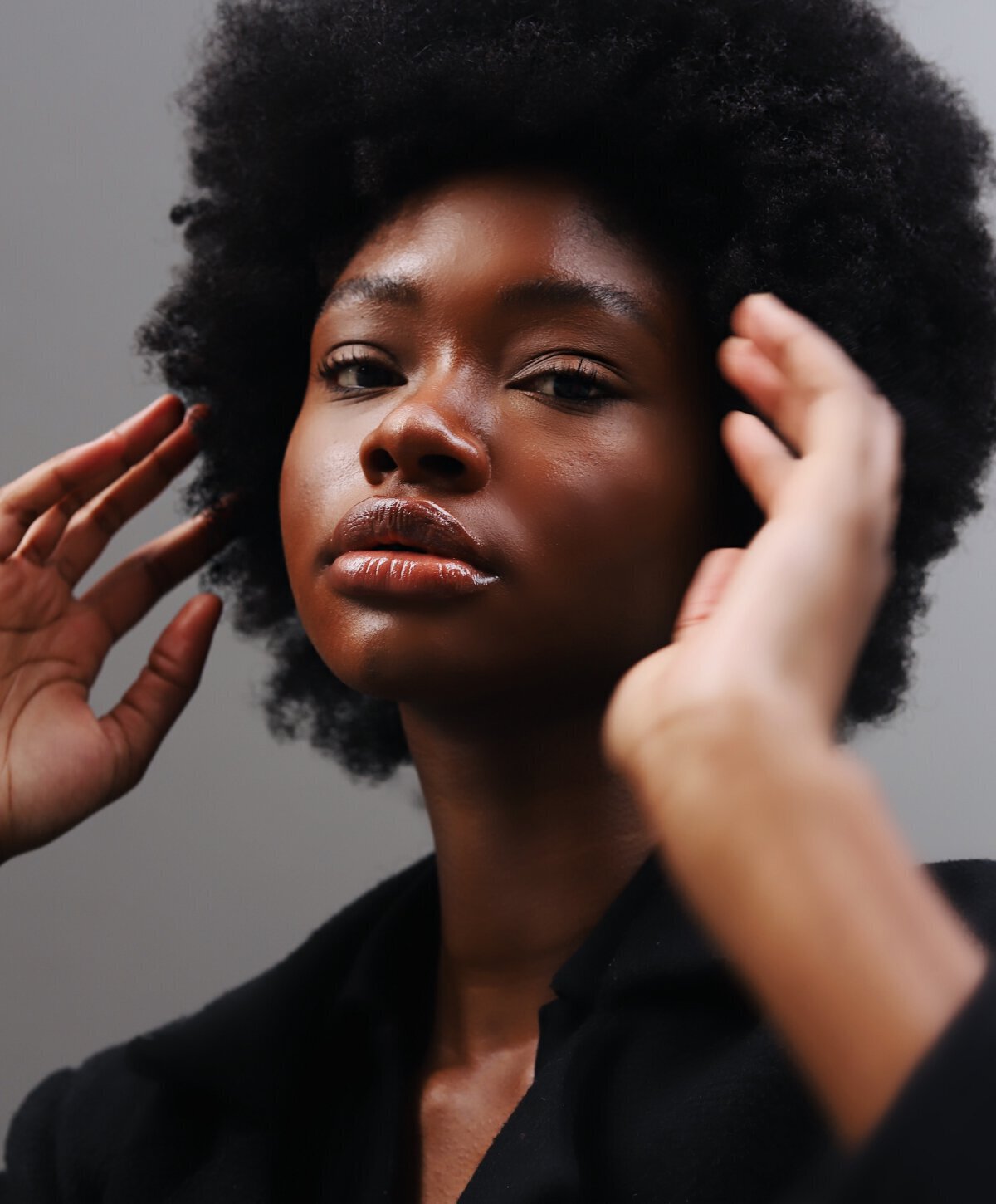 New Jersey Radiesse model wearing a black top