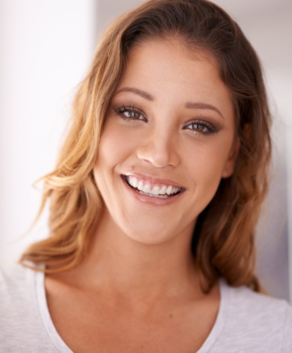 Smiling  liquid facelift New Jersey model