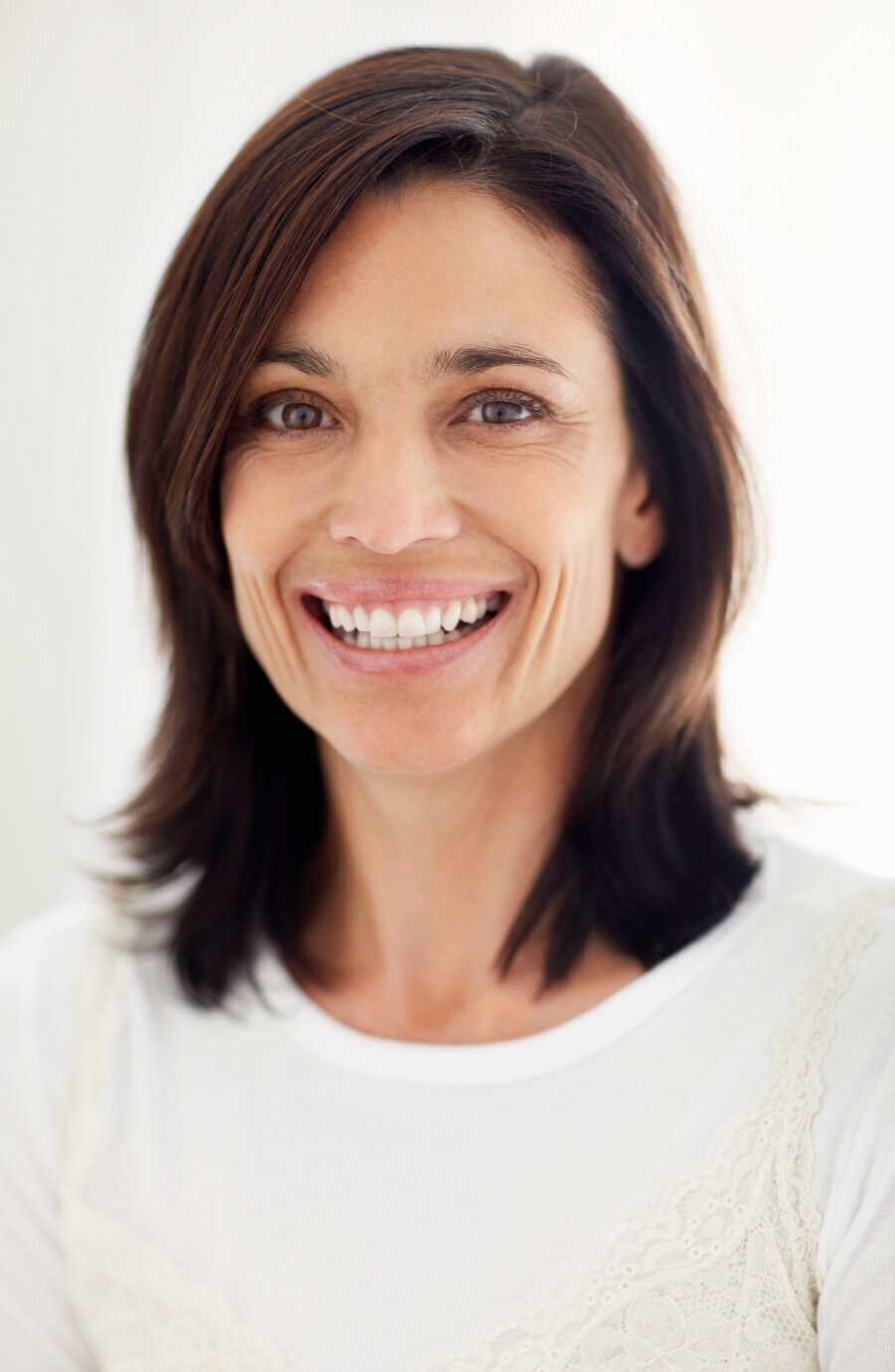 New Jersey IPL photofacial model smiling