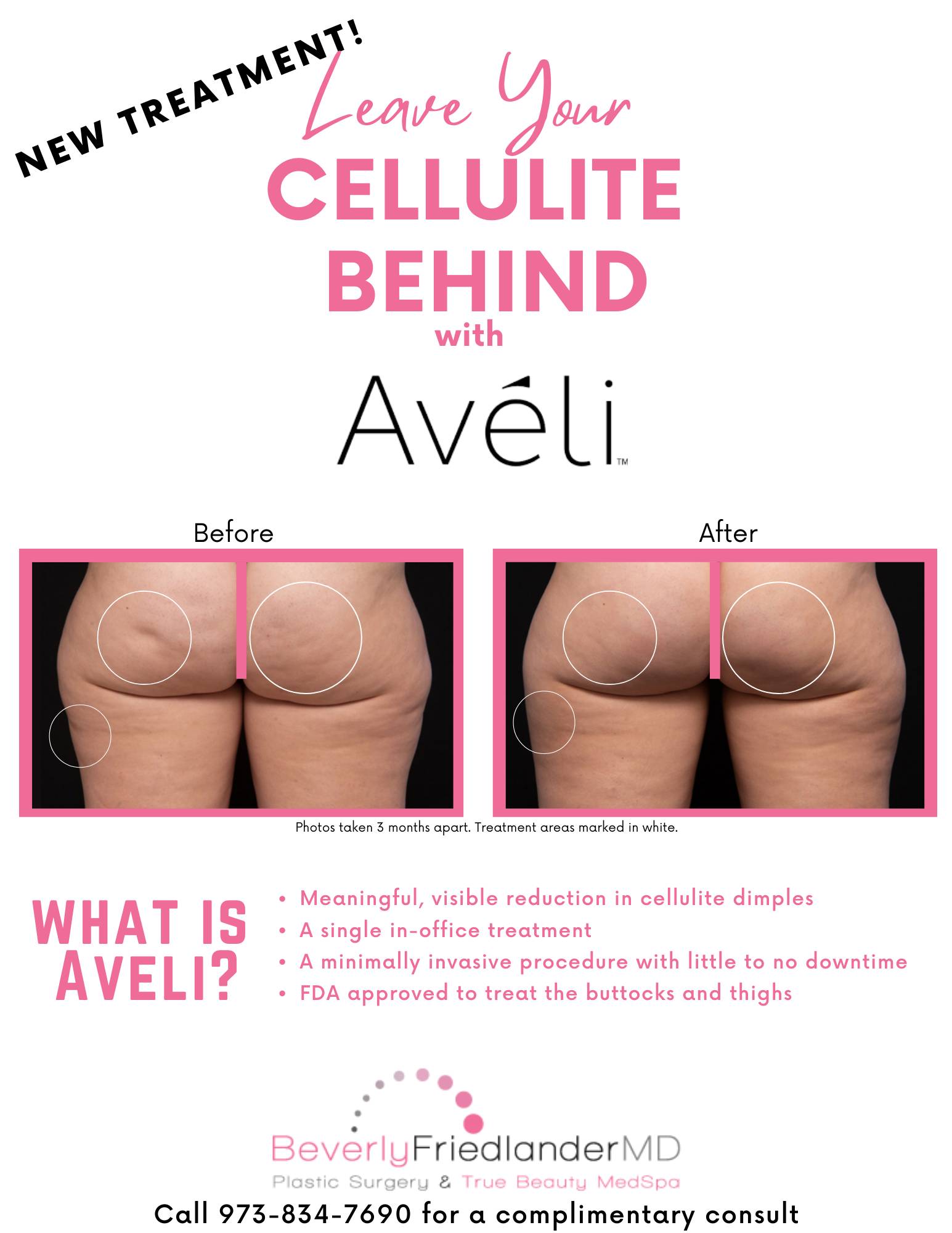 Aveli special