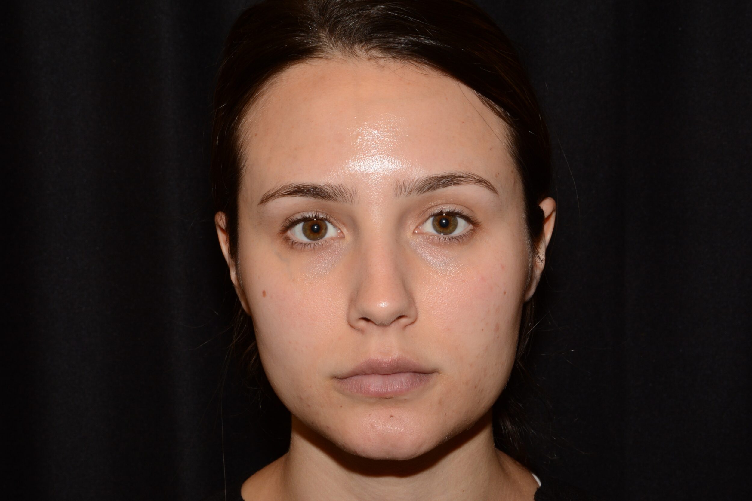 After Image: Eleven’s Forehead - front