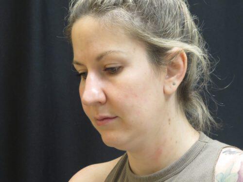 Before Image: CoolSculpting - left-front-oblique