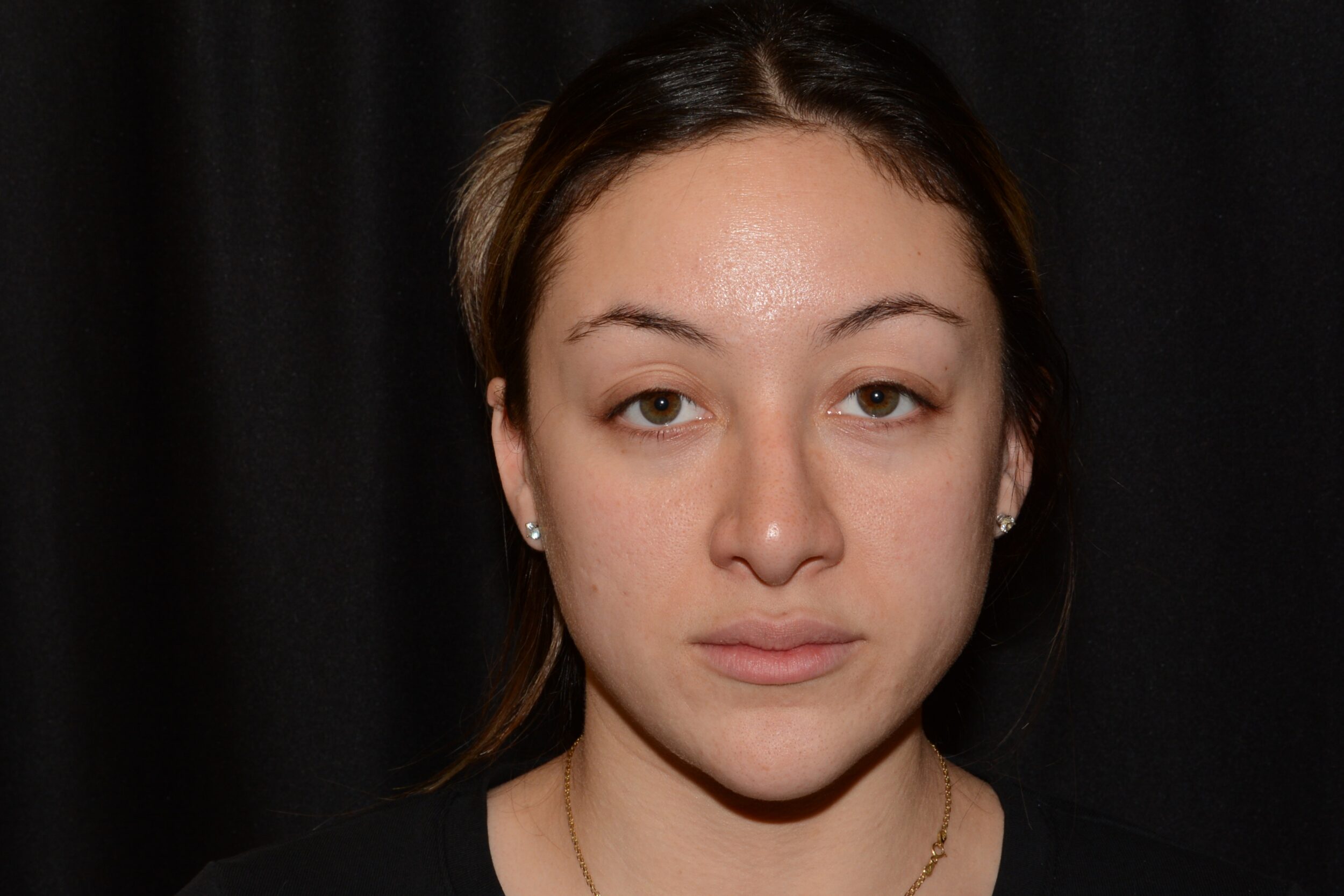 After Image: Eleven’s - front