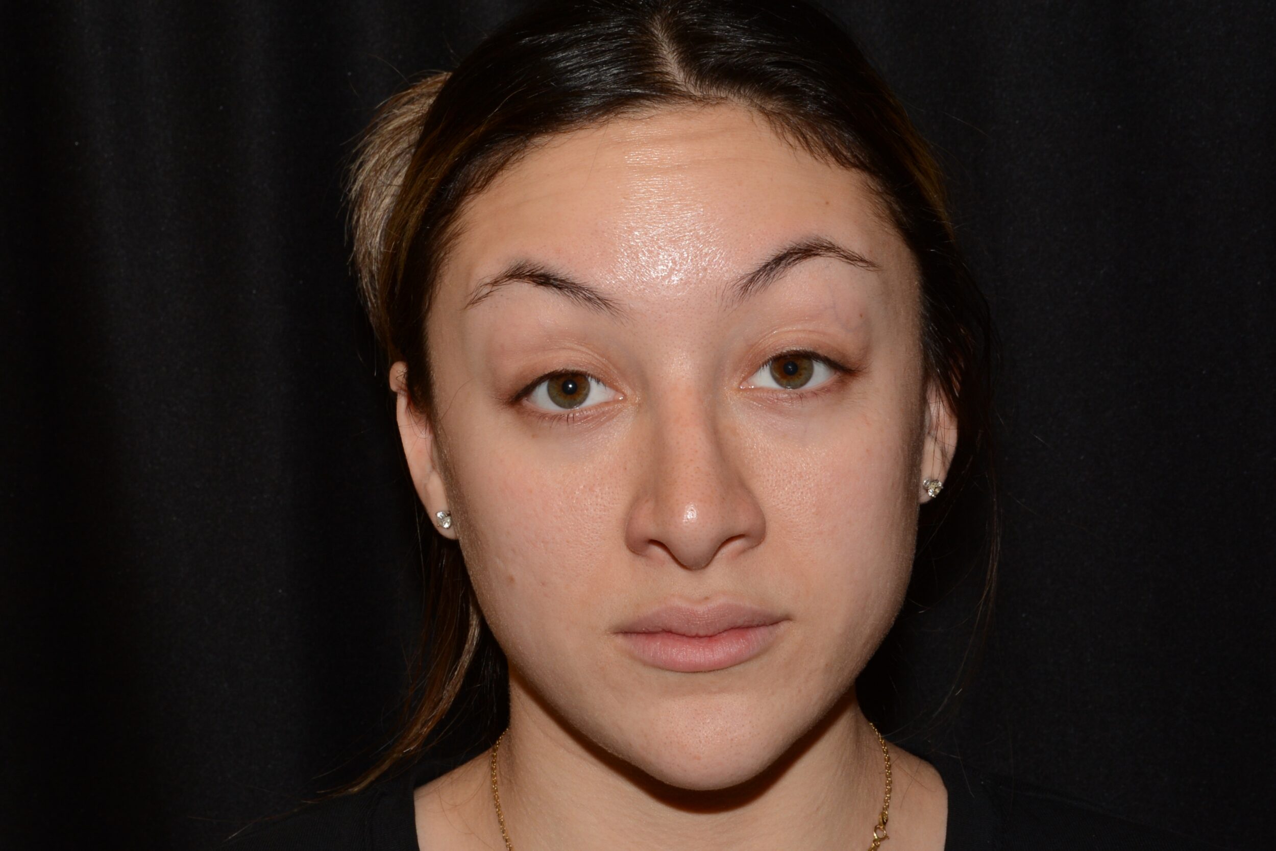 After Image: Eleven’s - front