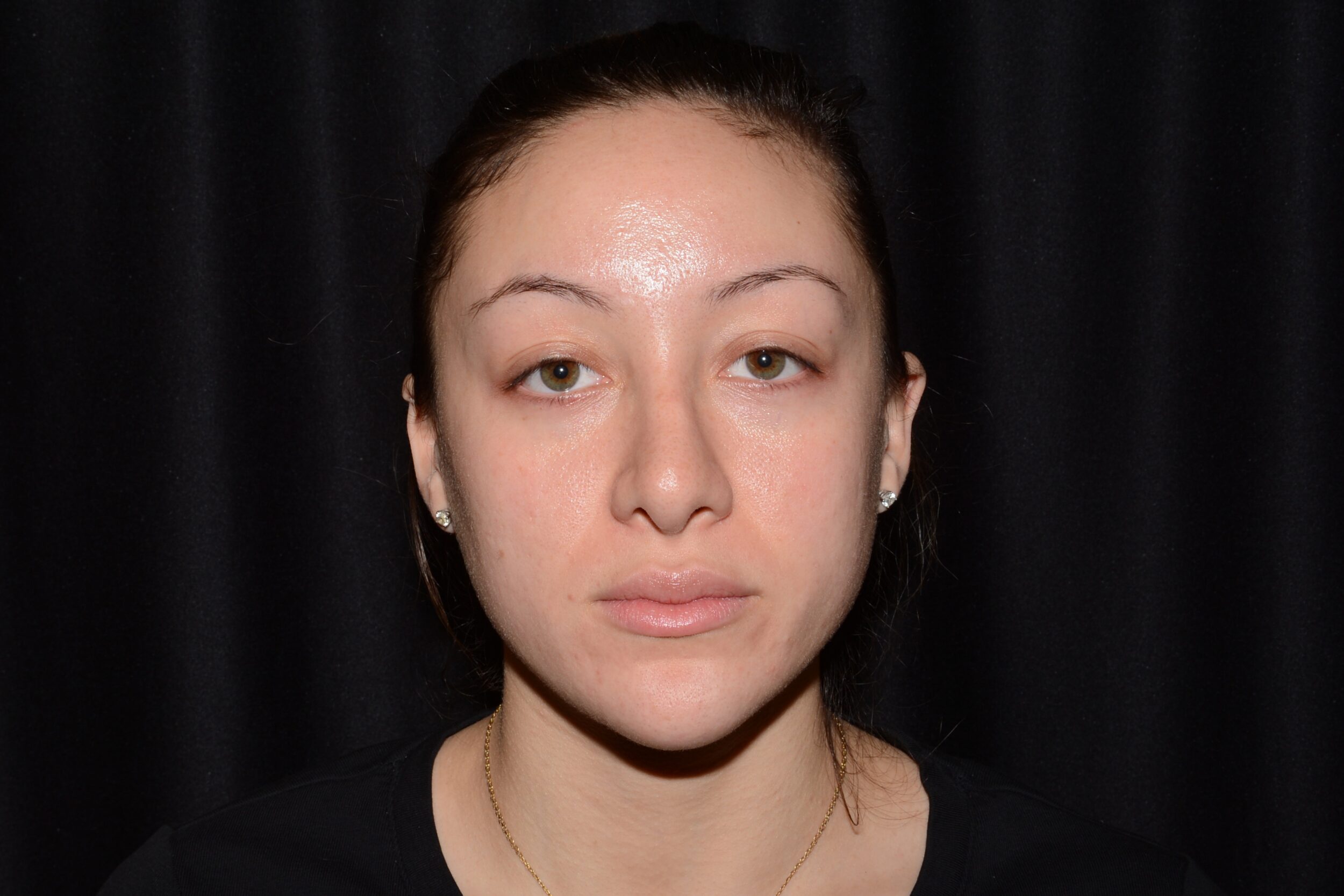 Before Image: Eleven’s - front