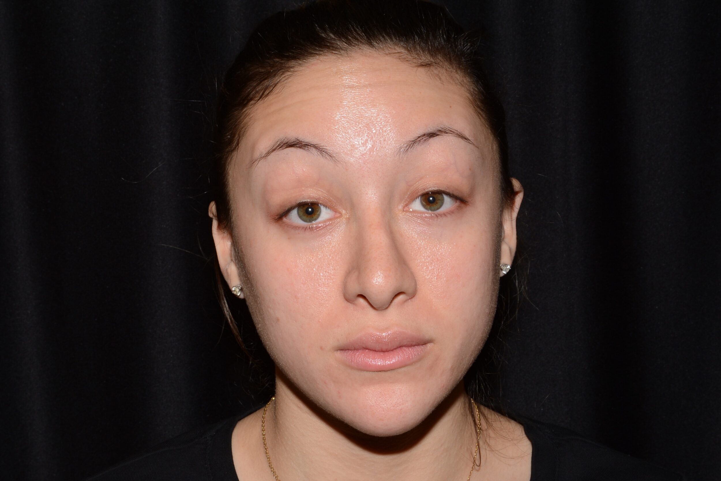 Before Image: Eleven’s - front