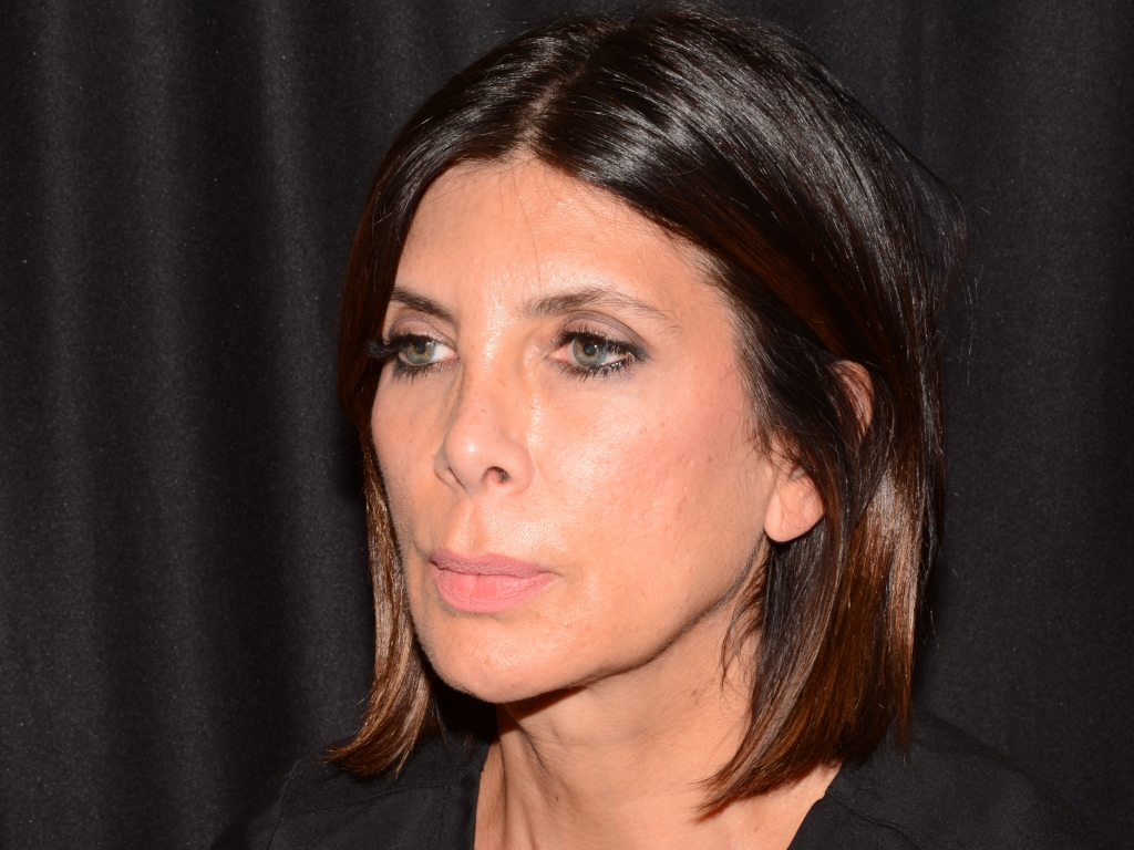 After Image: Sculptra - left-front-oblique