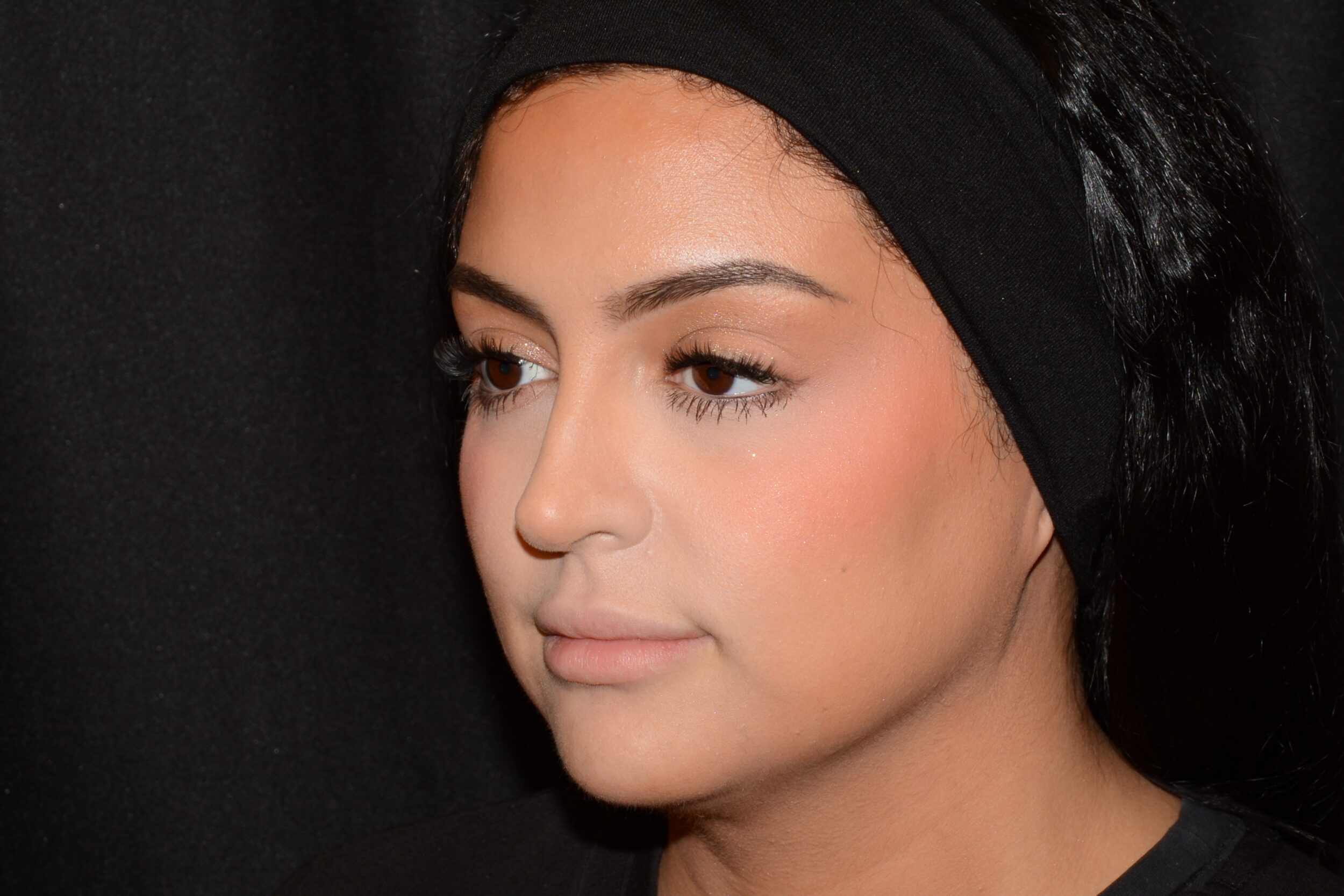 Before Image: Lip Filler - left-front-oblique